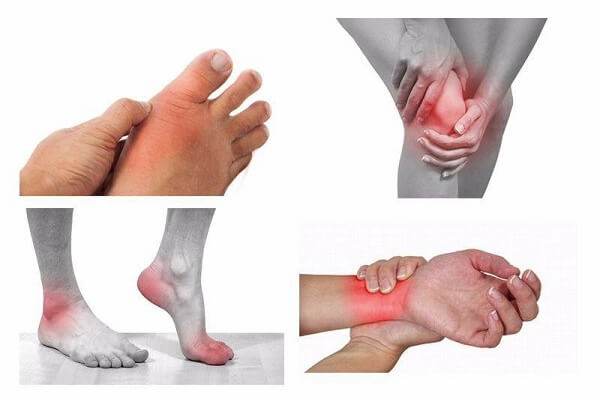 Viêm xương khớp vào ban đêm có triệu chứng gì?