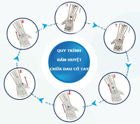 Cách massage bấm huyệt trị đau cổ tay